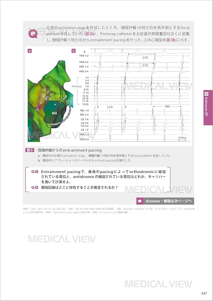 From Basic to Advanced EPS カンファレンスで学ぶ 心臓電気生理